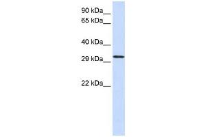 Western Blotting (WB) image for anti-Chromosome 21 Open Reading Frame 2 (C21orf2) antibody (ABIN2458962) (C21orf2 antibody)