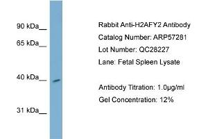 WB Suggested Anti-H2AFY2  Antibody Titration: 0. (H2AFY2 antibody  (Middle Region))