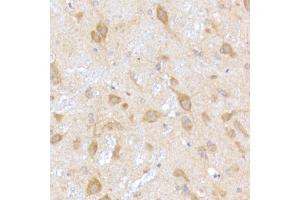 Immunohistochemistry of paraffin-embedded rat brain using TR Rabbit mAb (ABIN7270870) at dilution of 1:200 (40x lens). (TRAPPC2 antibody)