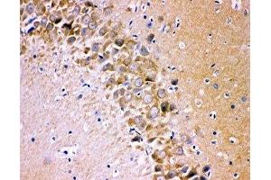 IHC-P testing of rat brain tissue (Glutamate Receptor 1 antibody  (AA 19-360))
