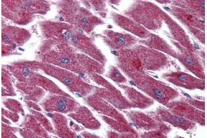 Human Heart (formalin-fixed, paraffin-embedded) stained with LPAR3 antibody ABIN399993 at 5 ug/ml followed by biotinylated goat anti-rabbit IgG secondary antibody ABIN481713, alkaline phosphatase-streptavidin and chromogen. (LPAR3 antibody  (Internal Region))