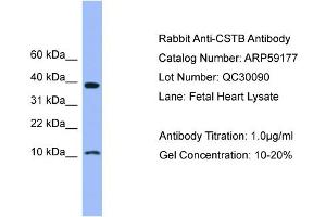 WB Suggested Anti-CSTB  Antibody Titration: 0. (CSTB antibody  (N-Term))