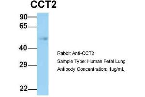 Host: Rabbit  Target Name: CCT2  Sample Tissue: Human Fetal Lung  Antibody Dilution: 1. (CCT2 antibody  (N-Term))
