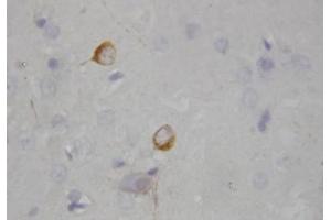 Immunohistochemistry (IHC) image for anti-Nitric Oxide Synthase 1, Neuronal (NOS1) (AA 1-181), (N-Term) antibody (ABIN1108474) (NOS1 antibody  (N-Term))