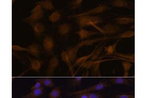 Immunofluorescence analysis of C6 cells using TIMP2 Polyclonal Antibody at dilution of 1:100. (TIMP2 antibody)