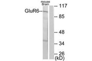 Western blot analysis of extracts from mouse brain cells, using mGluR6 Antibody. (Metabotropic Glutamate Receptor 6 antibody  (AA 828-877))