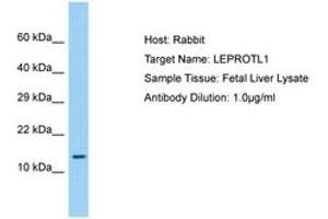 Image no. 1 for anti-Leptin Receptor Overlapping Transcript-Like 1 (LEPROTL1) (AA 37-86) antibody (ABIN6750210) (LEPROTL1 antibody  (AA 37-86))