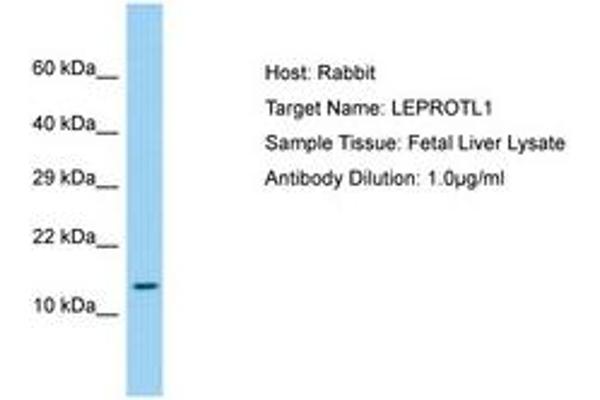 LEPROTL1 anticorps  (AA 37-86)