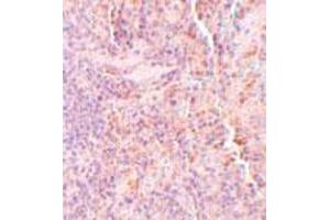 Immunohistochemical staining of rat spleen tissue with 5 ug/mL SQSTM1 polyclonal antibody . (SQSTM1 antibody  (C-Term))