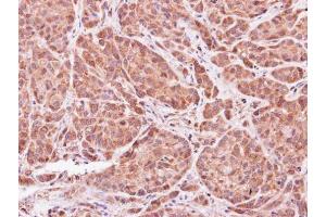 IHC-P Image Immunohistochemical analysis of paraffin-embedded A549 xenograft, using ASB9, antibody at 1:500 dilution. (ASB9 antibody)