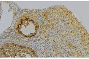 ABIN6277028 at 1/100 staining Human gastric tissue by IHC-P. (Peroxiredoxin 6 antibody  (Internal Region))