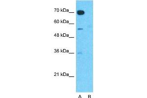 Host:  Rabbit  Target Name:  TMEM16A  Sample Type:  Human Fetal Muscle  Lane A:  Primary Antibody  Lane B:  Primary Antibody + Blocking Peptide  Primary Antibody Concentration:  1ug/ml  Peptide Concentration:  5ug/ml  Lysate Quantity:  25ug/lane/lane  Gel Concentration:  0. (ANO1 antibody  (Middle Region))