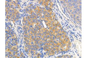ABIN6258520 and ABIN6274742 at 1/100 staining Rat ovarian tissue by IHC-P. (MRPL44 antibody  (C-Term))