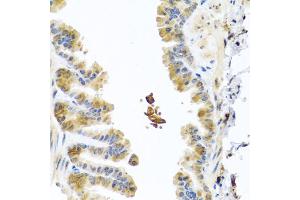 Immunohistochemistry of paraffin-embedded mouse lung using CHI3L2 antibody (ABIN5975154) at dilution of 1/100 (40x lens). (CHI3L2 antibody)