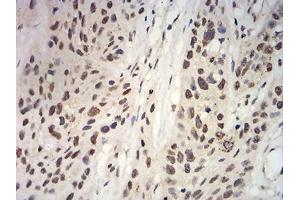 Immunohistochemistry (IHC) image for anti-Anaphase Promoting Complex Subunit 10 (ANAPC10) (AA 1-185) antibody (ABIN5542270)