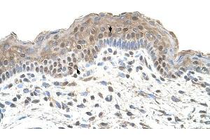 TAPBP antibody was used for immunohistochemistry at a concentration of 4-8 ug/ml to stain Squamous epithelial cells (arrows) in Human Skin. (TAPBP antibody)