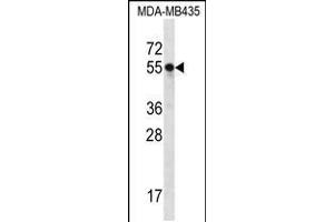 Western blot analysis in MDA-MB435 cell line lysates (35ug/lane). (SLC15A3 antibody  (AA 168-197))