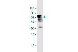 Western Blotting (WB) image for anti-Nuclear Factor of kappa Light Polypeptide Gene Enhancer in B-Cells Inhibitor, alpha (NFKBIA) (AA 1-317) antibody (ABIN1326940)