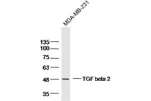 MDA-MB-231 lysates probed with TGF beta 2 Polyclonal Antibody, Unconjugated  at 1:300 dilution and 4˚C overnight incubation. (TGFB2 antibody  (AA 351-414))