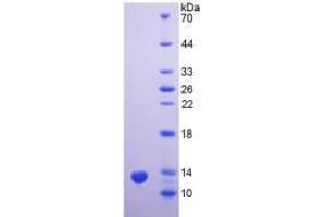 SDS-PAGE analysis of Human PSCA Protein. (PSCA Protein)