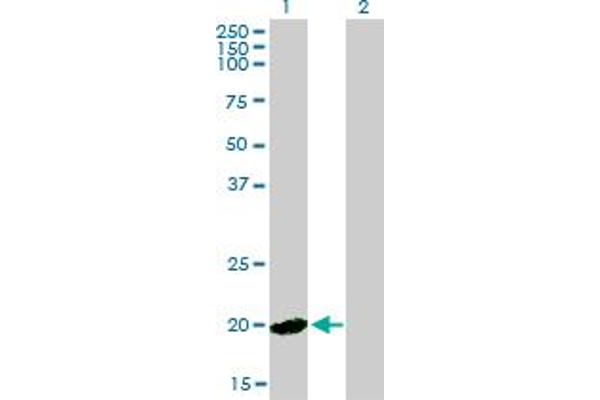 HPCAL4 antibody  (AA 1-191)