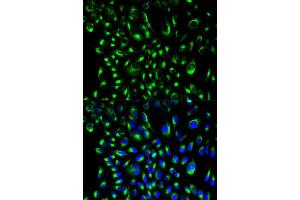 Immunofluorescence analysis of HeLa cell using LCP2 antibody. (LCP2 antibody  (AA 284-533))