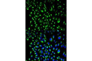 Immunofluorescence analysis of HeLa cell using LCP2 antibody. (LCP2 antibody  (AA 284-533))