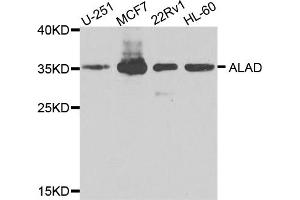 Western blot analysis of extracts of various cell lines, using ALAD antibody (ABIN5974581) at 1/1000 dilution. (ALAD antibody)