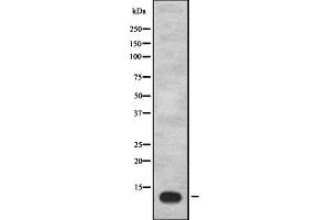 Western blot analysis of IGFL1 expression in Hela cell lysate,The lane on the left is treated with the antigen-specific peptide. (IGFL1 antibody)