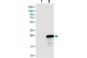 Western blot analysis of Lane 1: Negative control (vector only transfected HEK293T lysate), Lane 2: Over-expression Lysate (Co-expressed with a C-terminal myc-DDK tag (~3. (FLYWCH2 antibody)