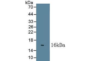 Detection of Recombinant NGF, Bovine using Polyclonal Antibody to Nerve Growth Factor (NGF) (Nerve Growth Factor antibody  (AA 122-241))