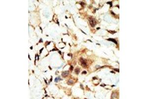 Image no. 2 for anti-Insulin Receptor (INSR) (N-Term) antibody (ABIN359886) (Insulin Receptor antibody  (N-Term))
