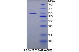 SDS-PAGE (SDS) image for NLR Family, Apoptosis Inhibitory Protein (NAIP) (AA 500-759) protein (His tag) (ABIN1878905)