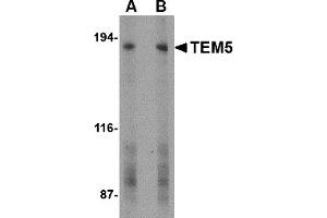 Western Blotting (WB) image for anti-G Protein-Coupled Receptor 124 (GPR124) (C-Term) antibody (ABIN1030729) (GPR124 antibody  (C-Term))
