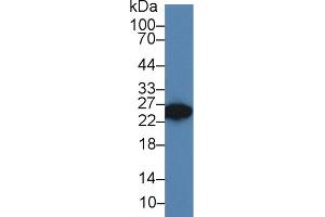 Western Blot; Sample: Rat Seminal vesicle lysate; Primary Ab: 3µg/ml Rabbit Anti-Rat DKKL1 Antibody Second Ab: 0. (Dickkopf-Like 1 (DKKL1) (AA 21-230) antibody)