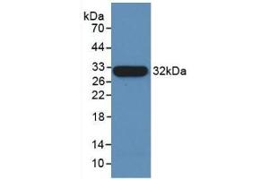 Detection of Recombinant TUBb, Human using Monoclonal Antibody to Tubulin Beta (TUBb) (TUBB antibody  (AA 170-419))