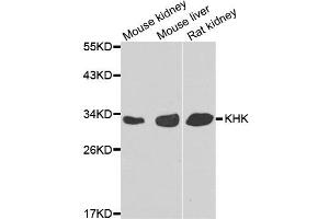 Western blot analysis of extracts of various cell lines, using KHK antibody.