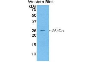 Western Blotting (WB) image for anti-Toll-Like Receptor Adaptor Molecule 2 (TICAM2) (AA 34-241) antibody (ABIN1860752) (TICAM2 antibody  (AA 34-241))