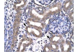 Image no. 1 for anti-KIN, Antigenic Determinant of RecA Protein Homolog (KIN) (AA 230-279) antibody (ABIN6735789) (KIN antibody  (AA 230-279))