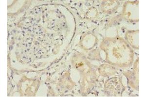 Immunohistochemistry of paraffin-embedded human kidney tissue using ABIN7171269 at dilution of 1:100 (STXBP6 antibody  (AA 2-210))