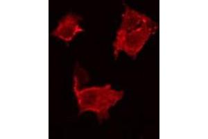 ABIN6266858 staining HeLa by IF/ICC. (BCAR3 antibody  (C-Term))