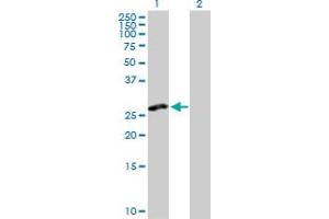 Western Blot analysis of CLEC2D expression in transfected 293T cell line by CLEC2D MaxPab polyclonal antibody. (CLEC2D antibody  (AA 1-191))