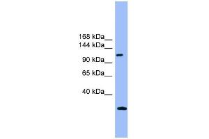 WB Suggested Anti-KIAA0226 Antibody Titration: 0.