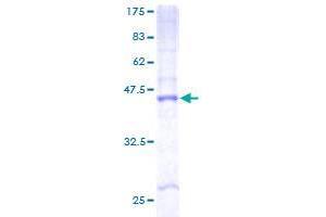 Image no. 1 for Cytochrome B-561 Domain Containing 2 (CYB561D2) (AA 1-222) protein (GST tag) (ABIN1350869) (CYB561D2 Protein (AA 1-222) (GST tag))