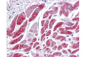 Anti-IDH2 antibody IHC of human heart. (IDH2 antibody  (AA 354-452))