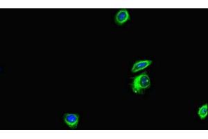 Immunofluorescent analysis of HepG2 cells using ABIN7144171 at dilution of 1:100 and Alexa Fluor 488-congugated AffiniPure Goat Anti-Rabbit IgG(H+L) (ANKS6 antibody  (AA 1-132))
