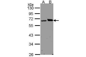 WB Image Sample(30 μg of whole cell lysate) A:H1299 B:Hep G2, 10% SDS PAGE antibody diluted at 1:1500