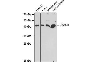 Western blot analysis of extracts of various cell lines, using HEXIM2 antibody (ABIN7267637) at 1:1000 dilution. (HEXIM2 antibody  (AA 147-286))