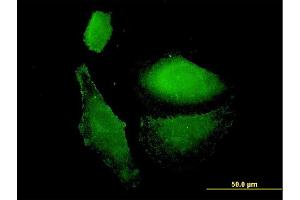 Immunofluorescence of monoclonal antibody to VAMP1 on HepG2 cell. (VAMP1 antibody  (AA 28-96))