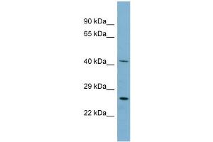 WB Suggested Anti-MRPS2 Antibody Titration: 0. (MRPS2 antibody  (N-Term))